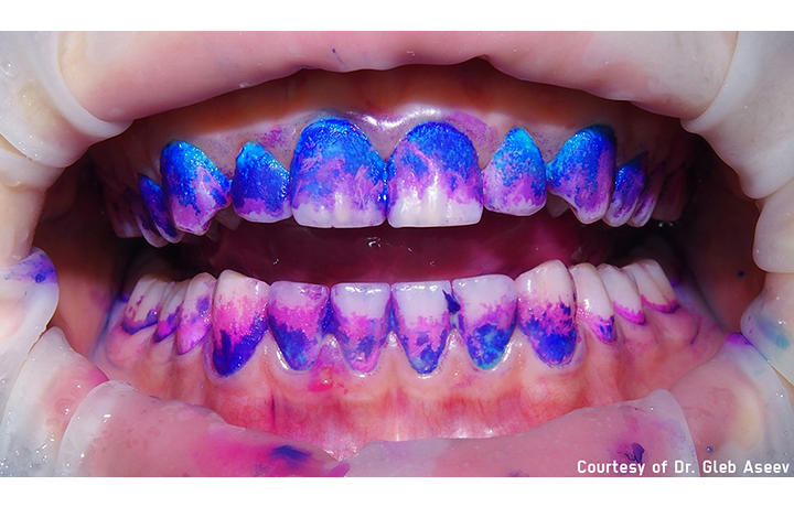 STEP2：染め出し