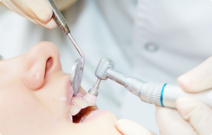 STEP5：ポリッシング